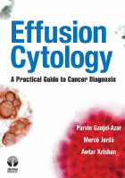 Effusion Cytology (2011).pdf